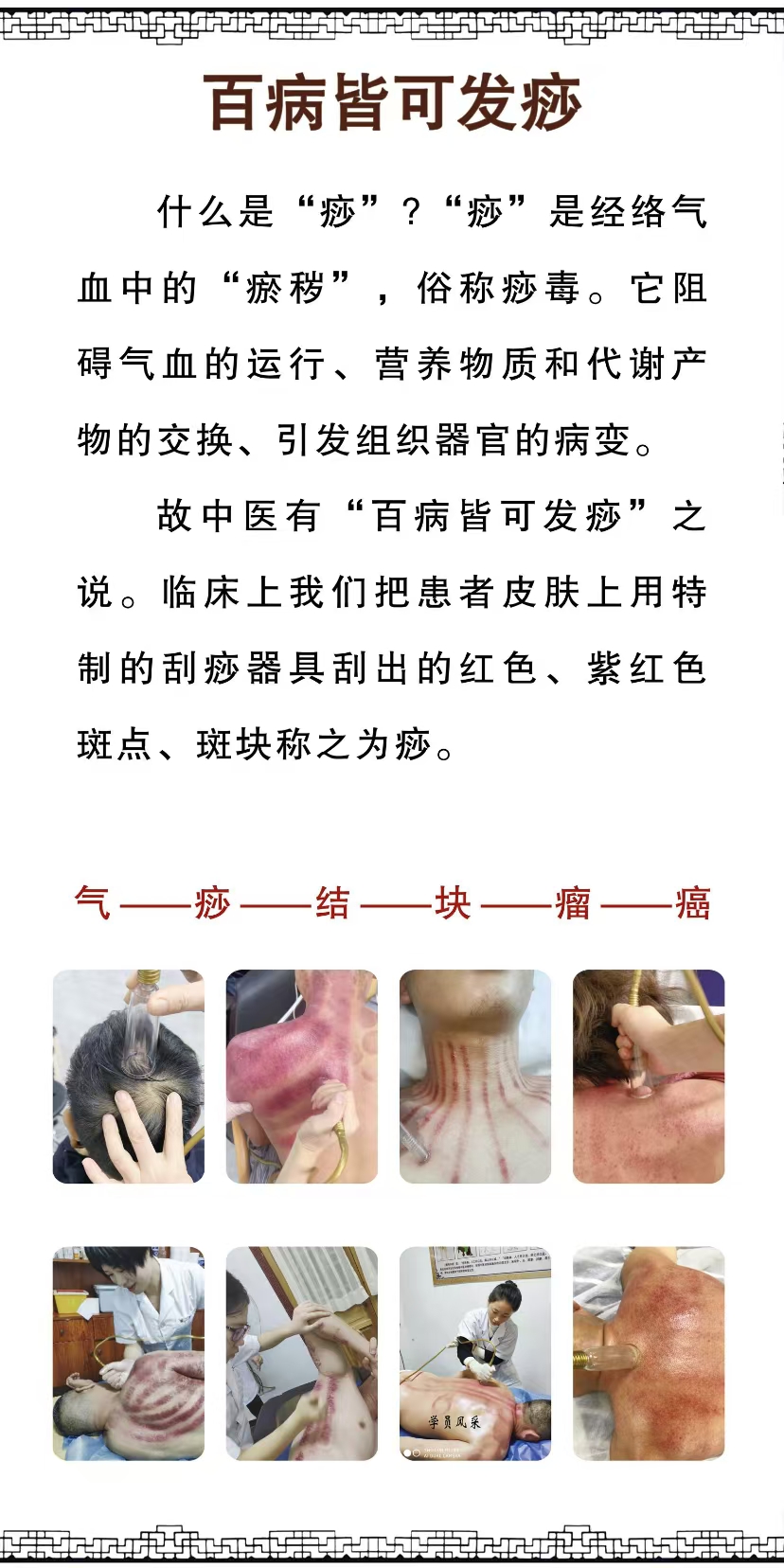 百病皆可發(fā)痧