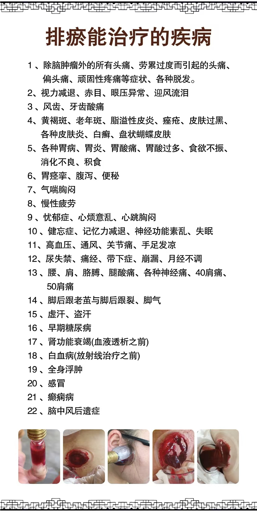 排瘀能治療的疾病