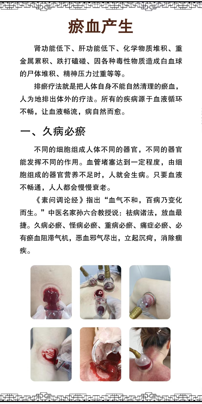 瘀血產(chǎn)生